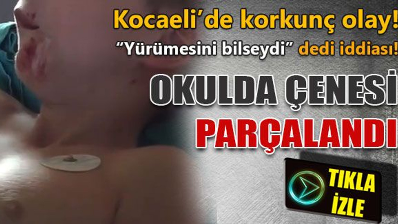 Kocaeli'de korkunç olay! 7 yaşındaki çocuğun okulda çenesi parçalandı