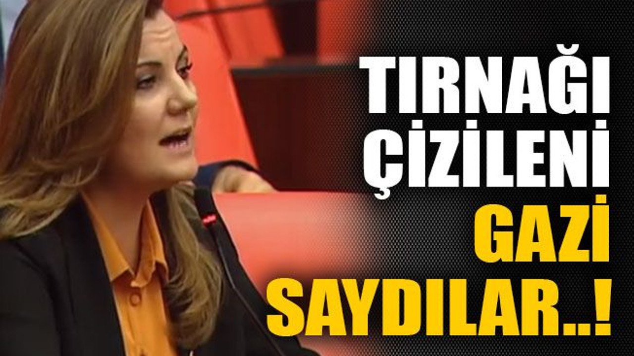 Tırnağı çizileni gazi saydılar..!