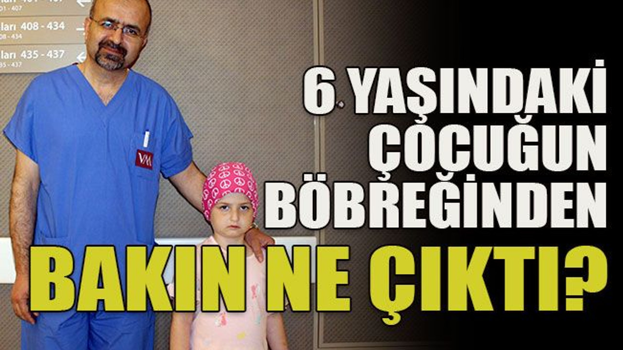 6 yaşındaki çocuğun böbreğinden bakın ne çıktı?