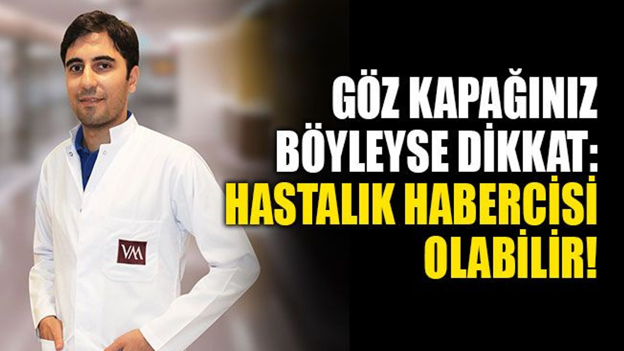 Göz kapağınız böyleyse dikkat: Hastalık habercisi olabilir!