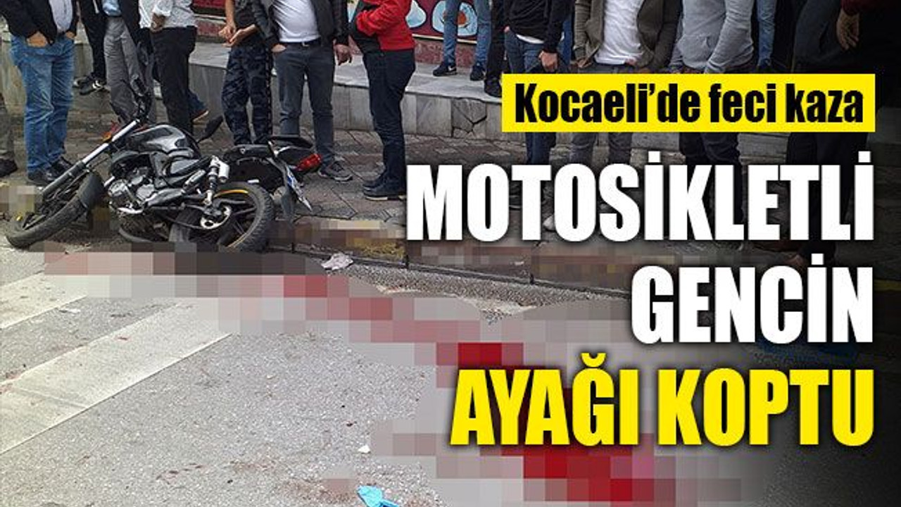 Kocaeli'de araçla çarpışan motosikletli gencin ayağı koptu