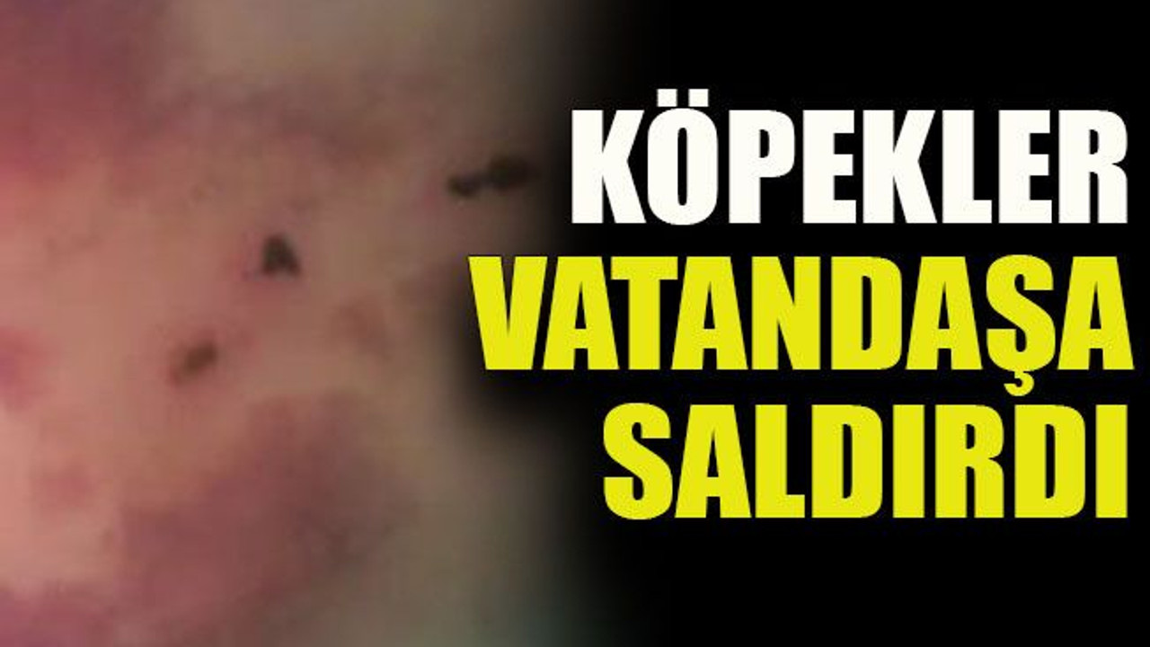 Köpekler vatandaşa saldırdı