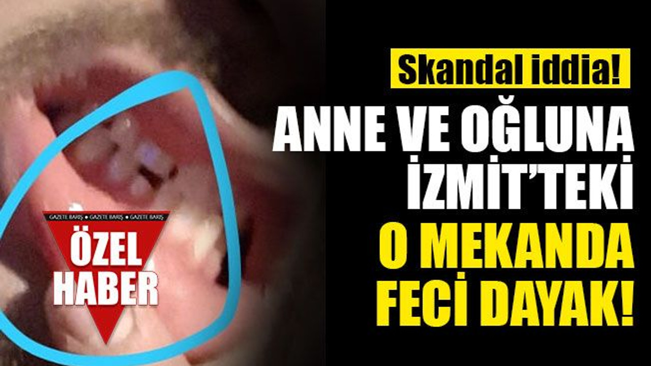 Skandal iddia: Anne ve oğluna İzmit’teki o mekanda feci dayak!