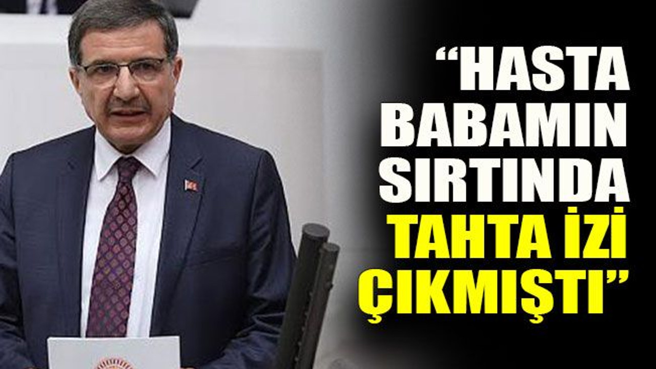 İlyas Şeker eski sağlık sistemini eleştirdi : “Hasta babamın sırtında tahta izi çıkmıştı”