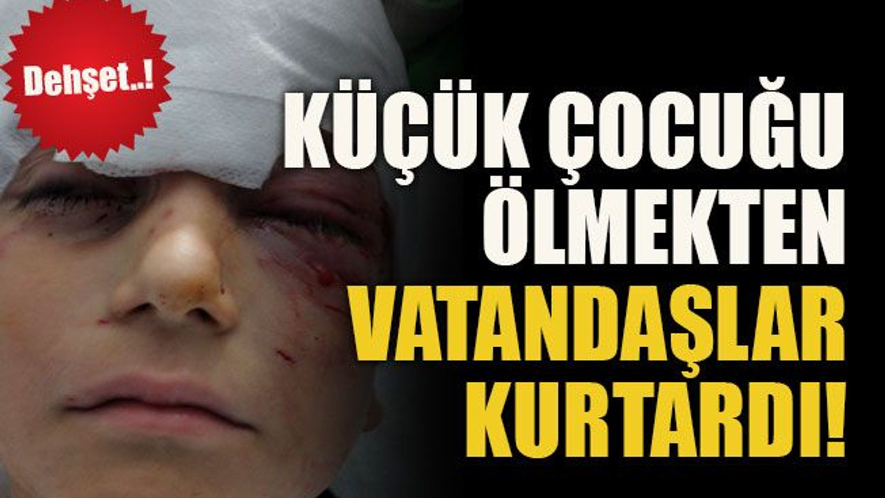 Dehşet..! Küçük çocuğu ölmekten vatandaşlar kurtardı!