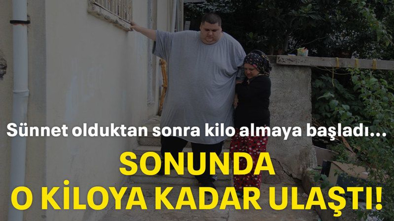 Sünnet olduktan sonra kilo almaya başladı..Sonunda o kiloya kadar ulaştı!