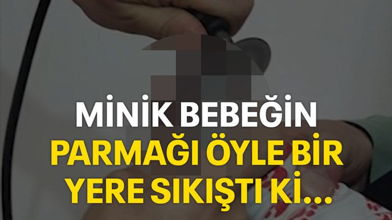 Minik bebeğin parmağı öyle bir yere sıkıştı ki...