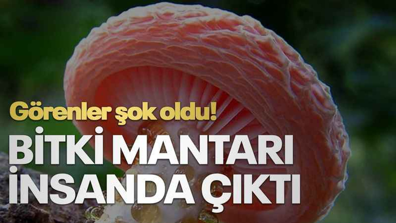 Görenler şok oldu! Bitki mantarı insanda çıktı