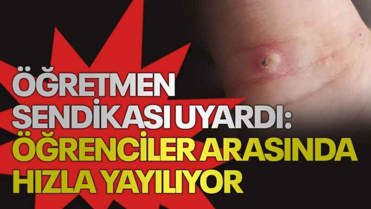 Öğretmen sendikası uyardı: Öğrenciler arasında hızla yayılıyor
