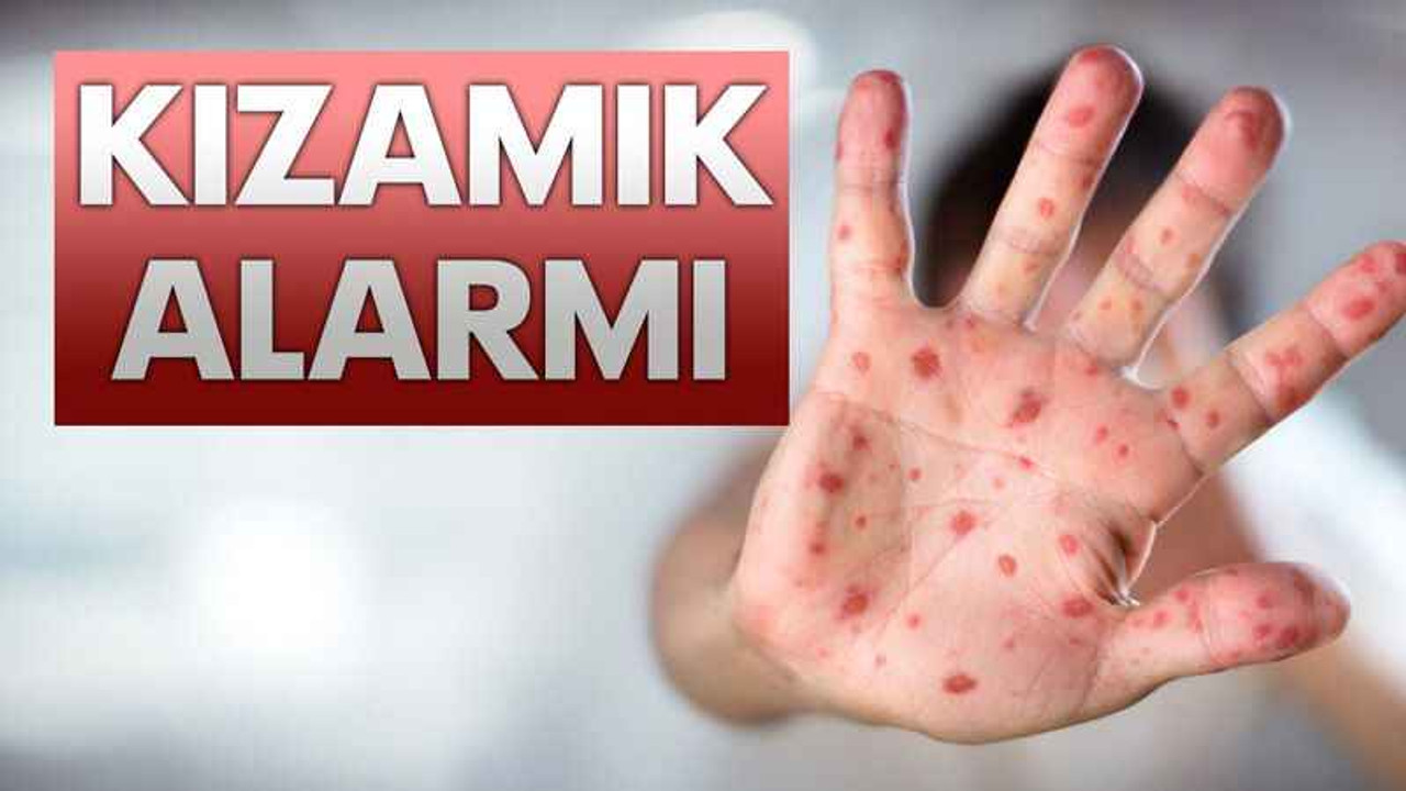 Kızamık alarmı