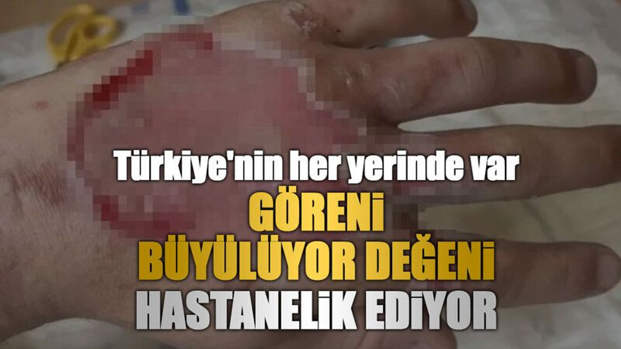 Türkiye'nin her yerinde var, Göreni büyülüyor değeni hastanelik ediyor