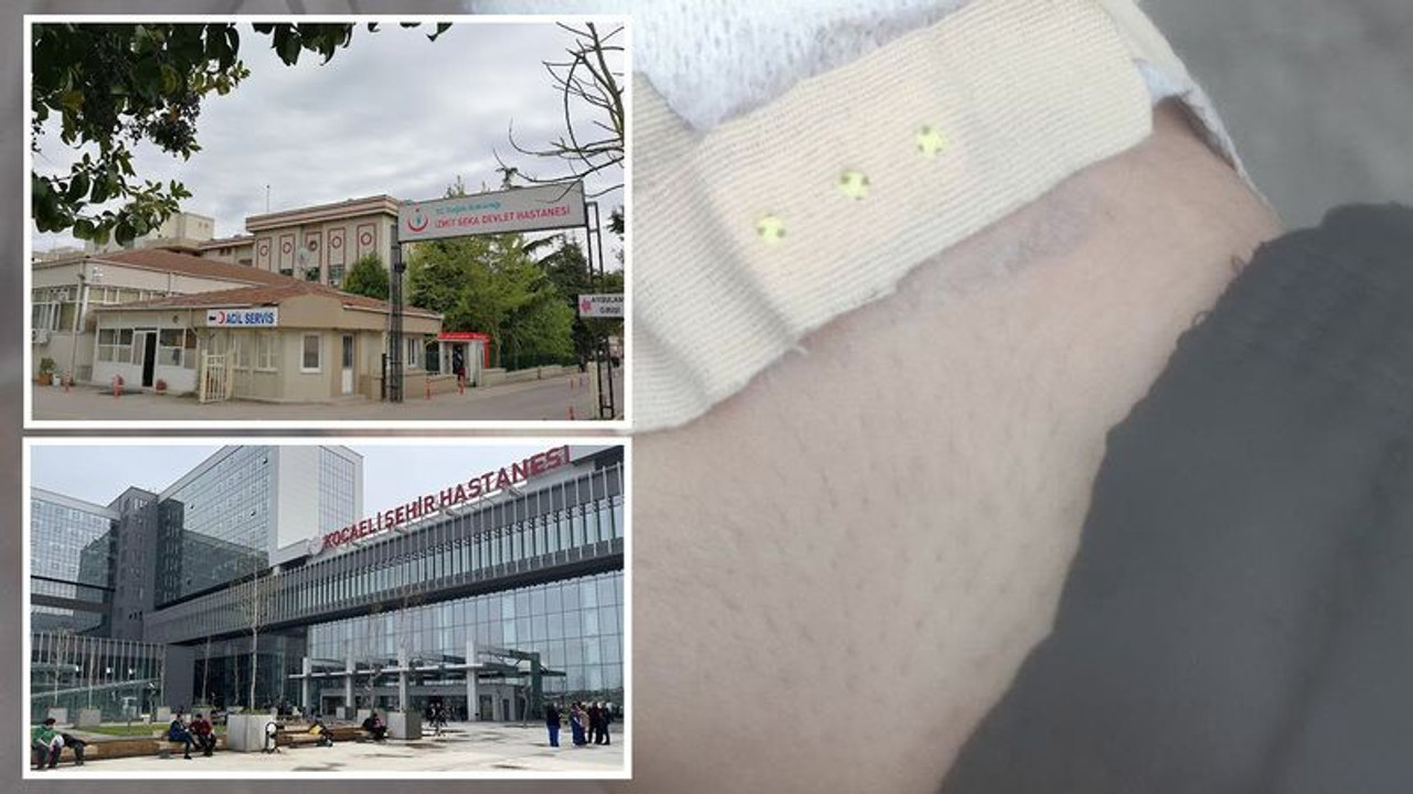 Eli kesilen vatandaşa Kocaeli'de “PANSUMAN” işkencesi: Yazıklar olsun!