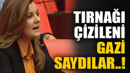 Tırnağı çizileni gazi saydılar..!