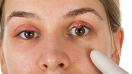 Bilim insanlarından bir corona uyarısı daha: Gözlere bunu yapıyor