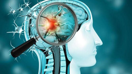 Covid-19 bir beyin hastalığı mı?