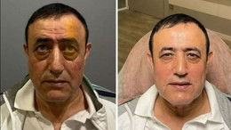 Yılların türkücüsü görenleri şaşırttı