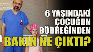 6 yaşındaki çocuğun böbreğinden bakın ne çıktı?