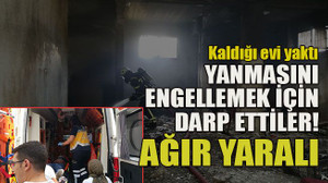 Kaldığı evi yaktı... Yanmasını engellemek için darp ettiler! Ağır yaralı