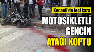 Kocaeli'de araçla çarpışan motosikletli gencin ayağı koptu