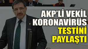 AKP’li vekil Koronavirüs testini paylaştı