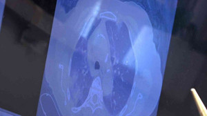 ‘Aşı kurnazlığı’ yapan vatandaşlar Covid servislerinin yolunu tutuyor