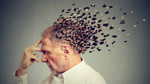 Japon bilim adamlarından Alzheimer tedavisinde umut olacak çalışma
