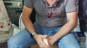 50 lira için dükkanı basıp darp etti!