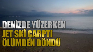Denizde yüzerken jet ski çarptı, ölümden döndü