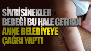 Sivrisinekler bebeği bu hale getirdi anne belediyeye çağrı yaptı
