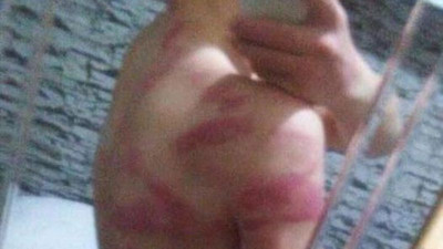Ülkücüler 14 yaşındaki çocuğu öldüresiye dövdü!