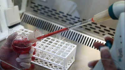 IQ seviyeleri zirveye çıkan kan grubu belli oldu: Zeki insanlar araştırıldı