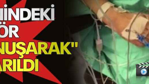 Beynindeki tümör "konuşarak" çıkarıldı