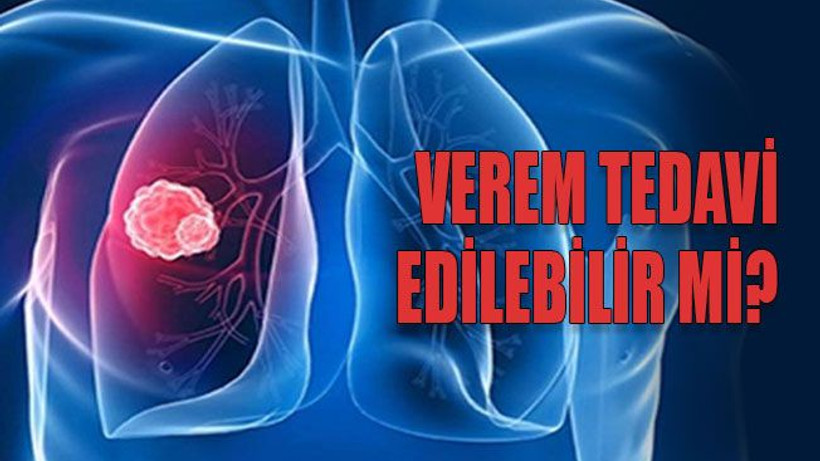 Verem tedavi edilebilir mi?