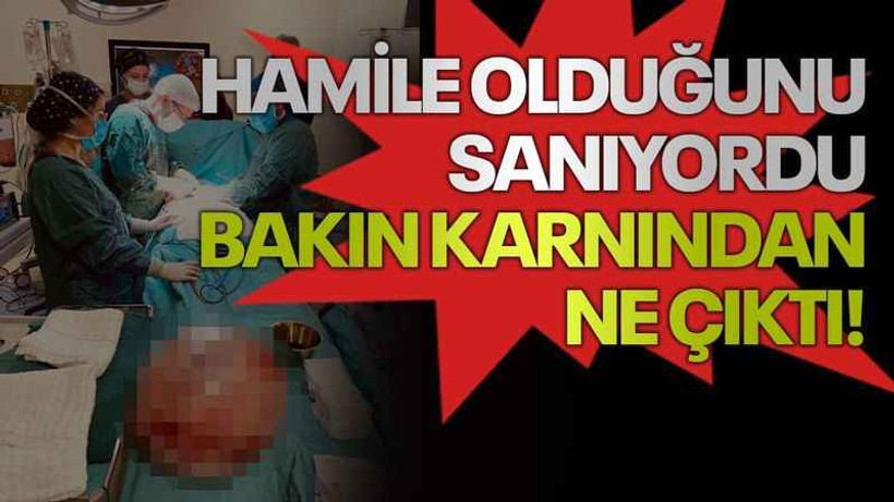 Hamile olduğunu sanıyordu, bakın karnından ne çıktı!