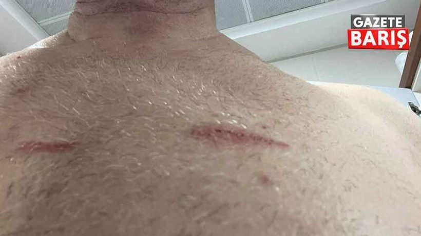 CHP’li milletvekili fotoğraflarını paylaşıp darp izlerini gösterdi!