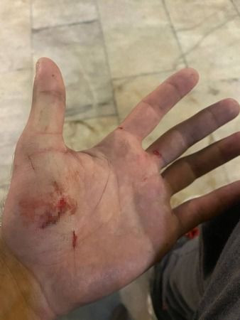 Trafikte tehlikeli paten yolculuğu hüsranla bitti