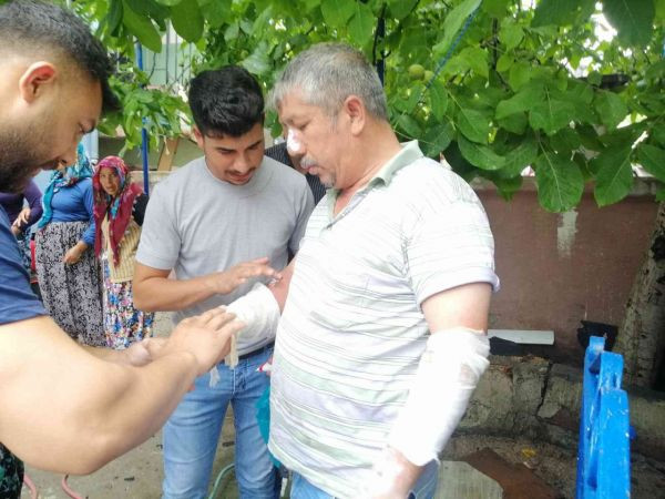 Kocaeli'de çıkan yangında eli ve yüzü yandı!