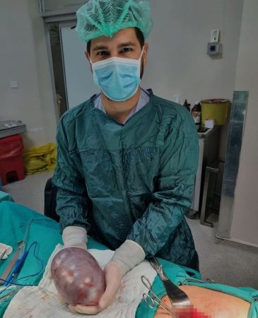 45 yaşındaki hastadan 17 santimetrelik tümör çıkarıldı