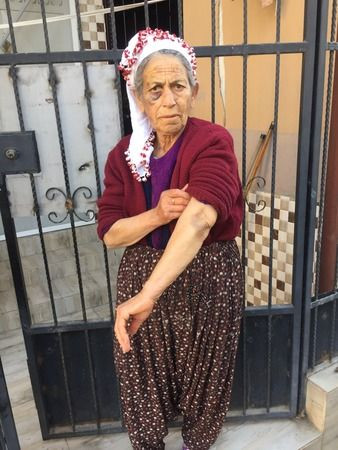 Adana'da kanser hastası kadına feci dayak