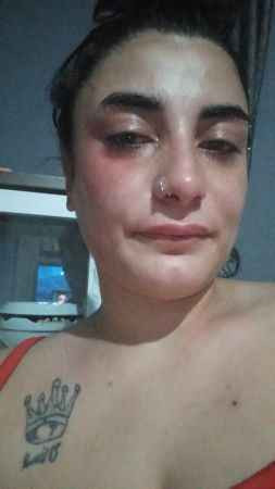 “Bu köpekleri nasıl besliyorsunuz” deyip hamile kadını dövdü