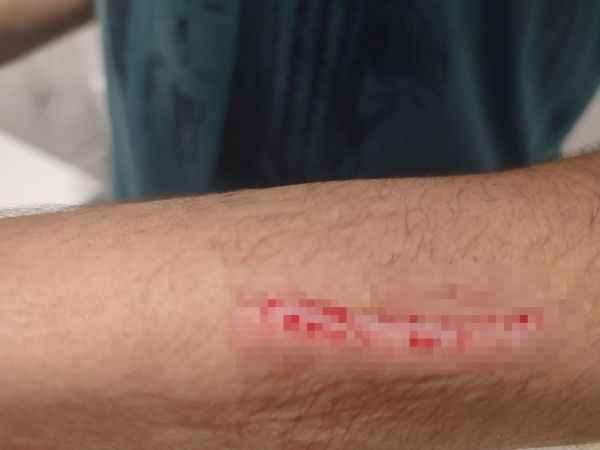 Gündüz vakti bisiklet süren gence saldırdılar
