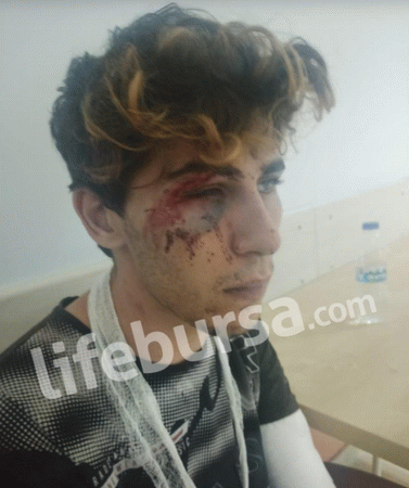 Suriyeliler engelli Türk gencini acımasızca dövüp kayda aldılar