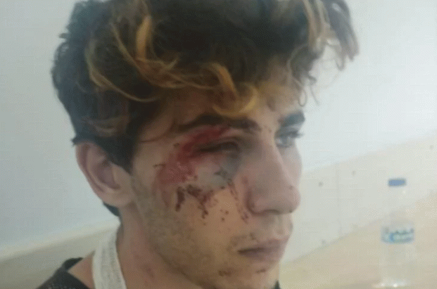 Suriyeliler engelli Türk gencini acımasızca dövüp kayda aldılar