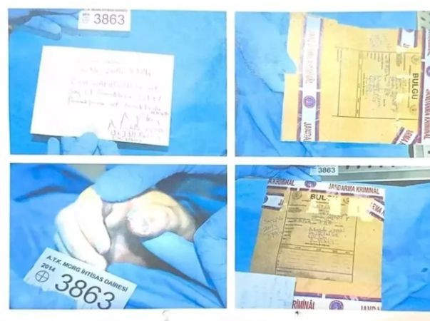Cem Garipoğlu'nun otopsi fotoğrafları ortaya çıktı, işte görüntüler!