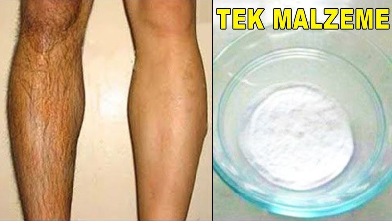 Yüzdeki tüy ve kıllardan kurtaran 9 doğal yöntem... Güzellik uzmanları asla anlatmaz
