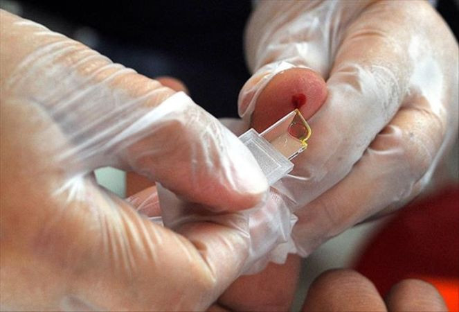 IQ seviyeleri zirveye çıkan kan grubu belli oldu: Zeki insanlar araştırıldı